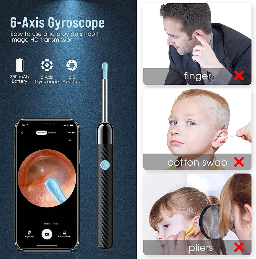 Smart Ear Cleaner Kit